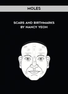 Moles - Scars and Birthmarks By Nancy Yeoh by https://illedu.com