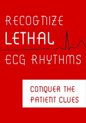 Robin Gilbert - Recognize Lethal ECG Rhythms: Conquer the Patient Clues courses available download now.